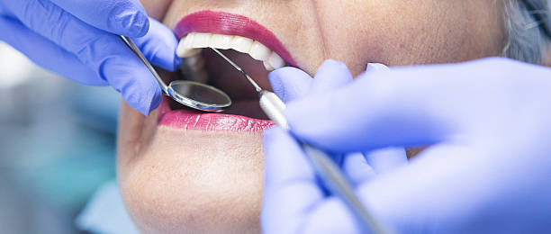 Best Emergency Broken Tooth Repair in West Fargo, ND